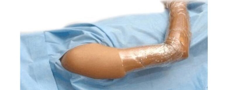 Arm-to-Elbow Drape by rizochem pharmaceuticals
