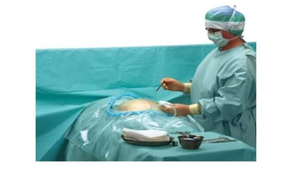 Cesarean Drape by rizochem pharmaceuticals