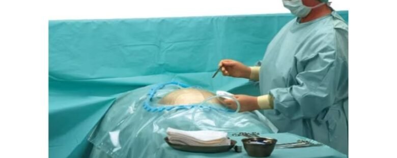 Cesarean Drape by rizochem pharmaceuticals