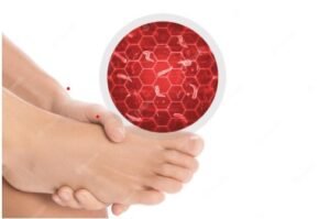 Fungal skin infections