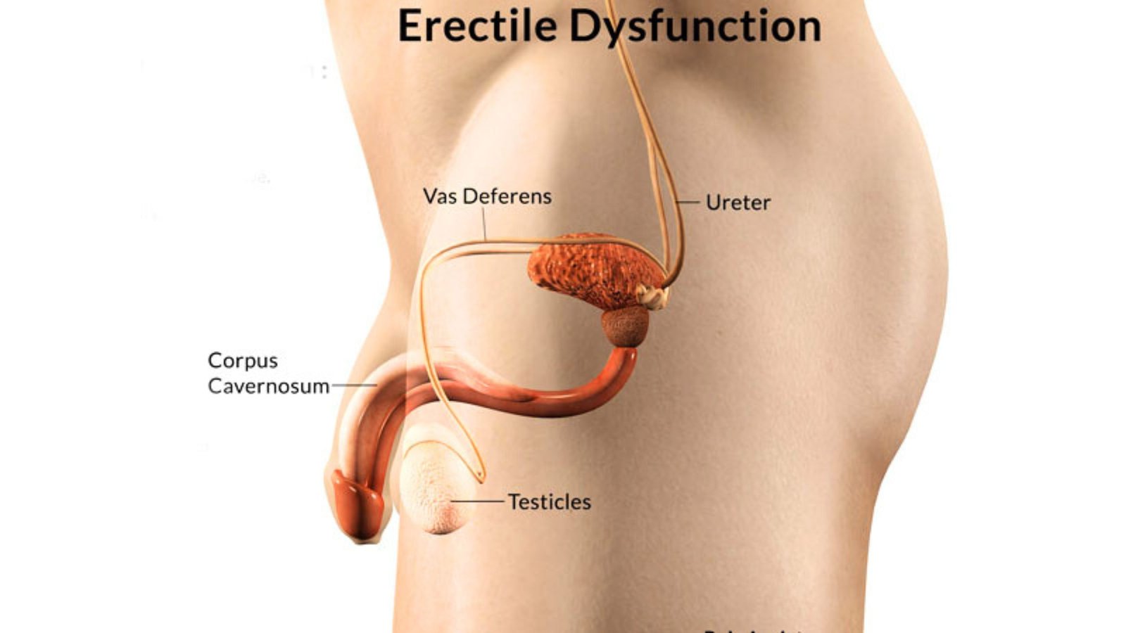 Erectile dysfunction