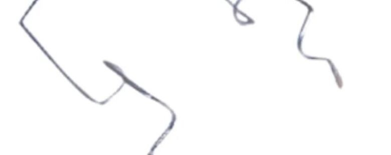 Wire Speculum Open Loop by rizochem pharmaceuticals